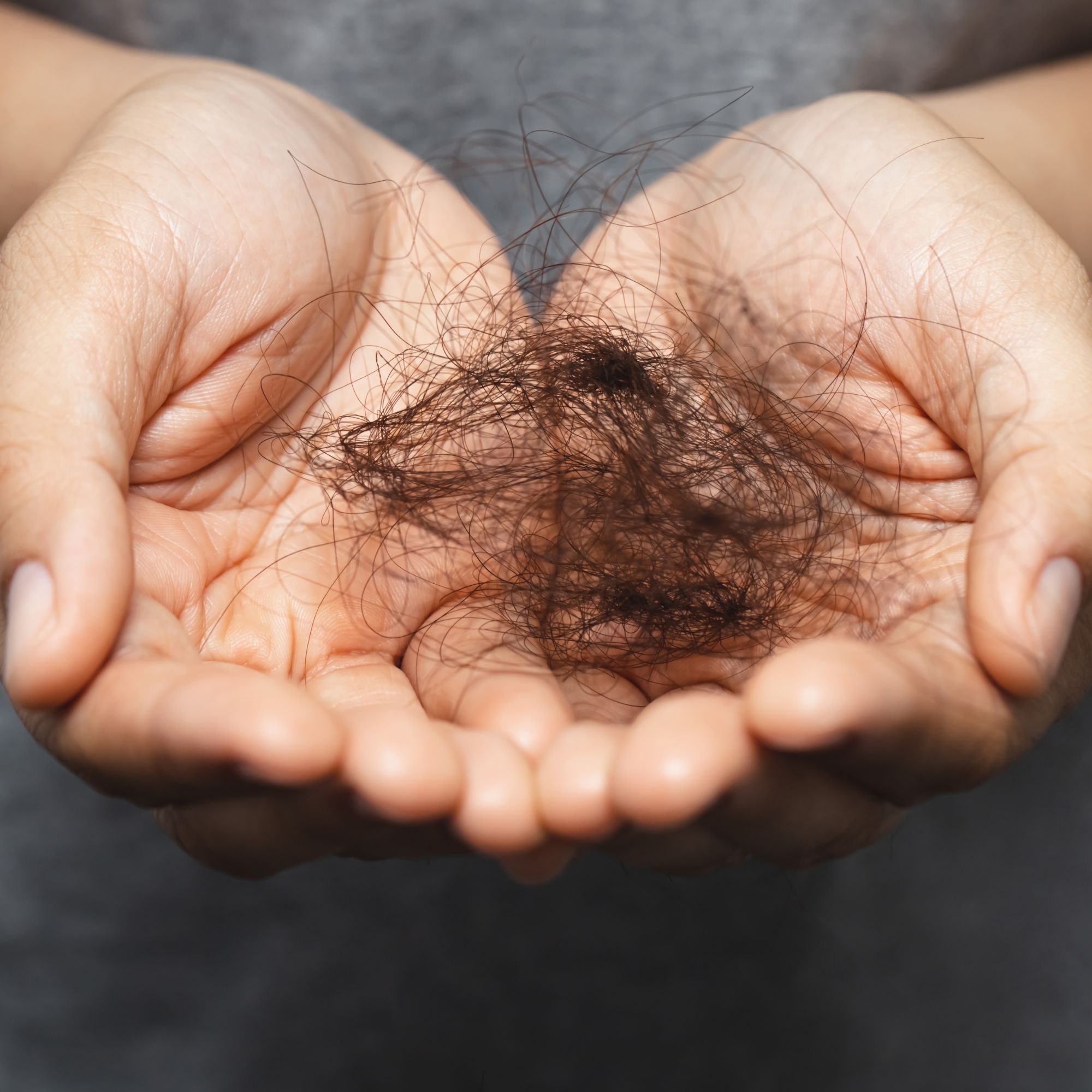 Can I Stop My Hair Falling Off