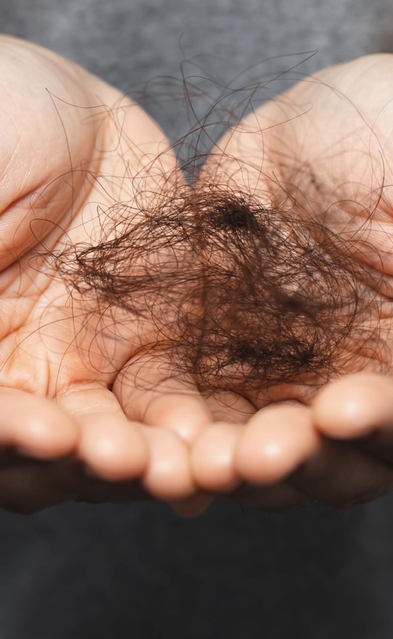 Can I Stop My Hair Falling Off