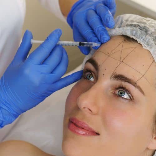 botox injection in london