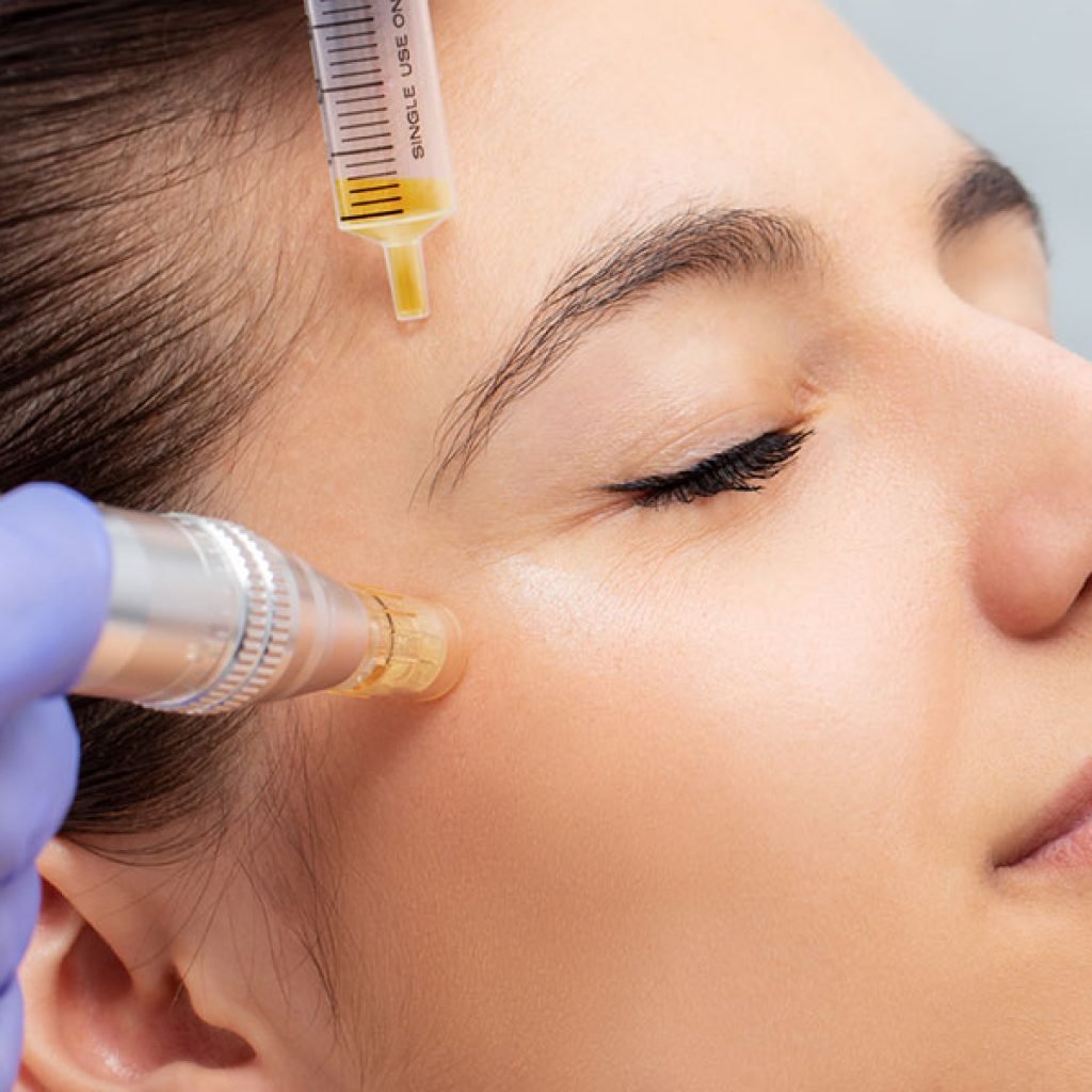 Harness the healing power of your blood's platelets with our Platelet-Rich Plasma treatment. Ideal for skin rejuvenation